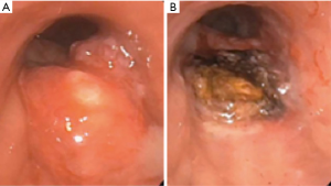 Click on image to zoom