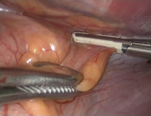 Click on image to zoom