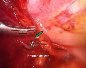 Click on image to zoom
