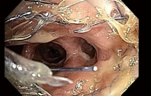 Click on image to zoom