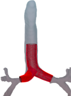 Click on image to zoom