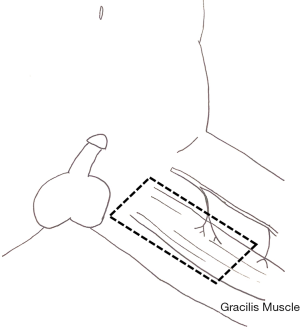 Click on image to zoom