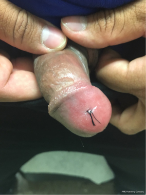 Click on image to zoom