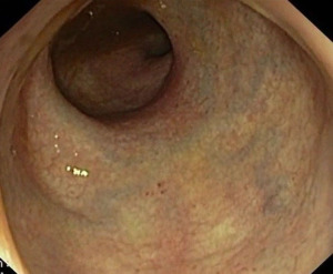 Click on image to zoom