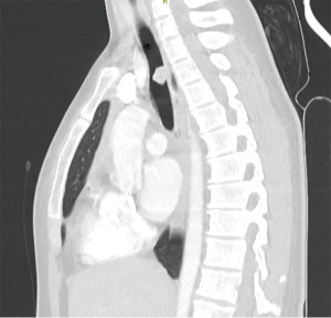 Click on image to zoom