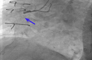 Click on image to zoom