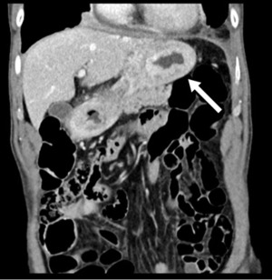 Click on image to zoom