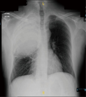 Click on image to zoom