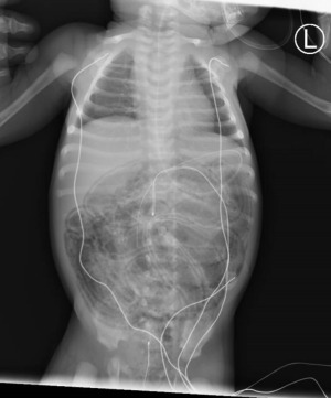 Click on image to zoom