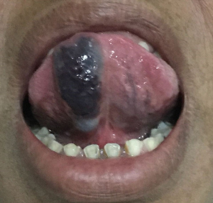 Click on image to zoom