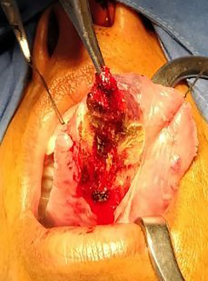 Click on image to zoom