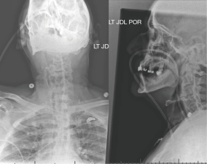 Click on image to zoom