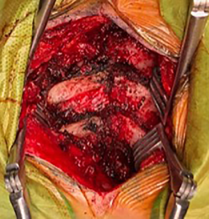 Click on image to zoom