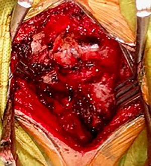 Click on image to zoom