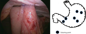 Click on image to zoom