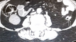 Click on image to zoom
