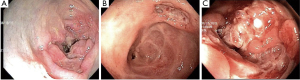 Click on image to zoom