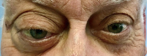Click on image to zoom