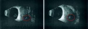 Click on image to zoom