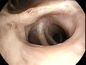 Click on image to zoom