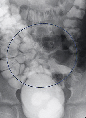 Click on image to zoom