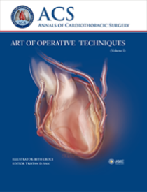 Annals of Cardiothoracic Surgery