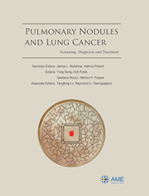 Pulmonary Nodules and Lung Cancer: screening, diagnosis and treatment