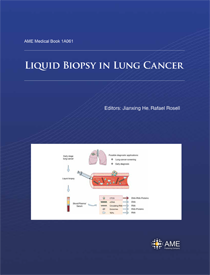 Liquid Biopsy in Lung Cancer