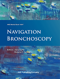 Navigation Bronchoscopy