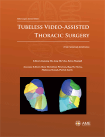 Tubeless Video-Assisted Thoracic Surgery (The Second Edition)