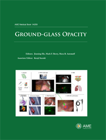 Ground-glass Opacity