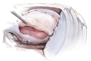 Figure 12