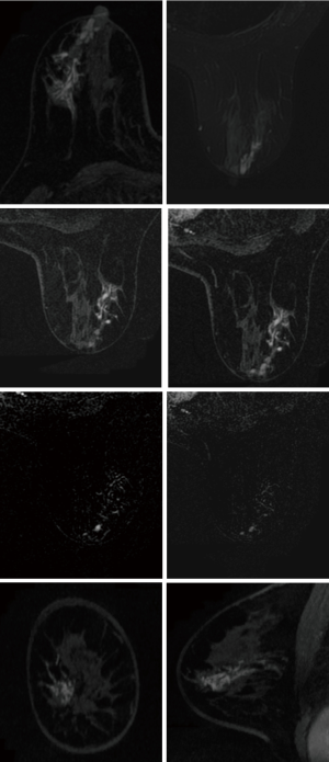 Figure 22