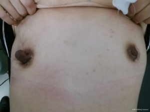 Longest Nipples