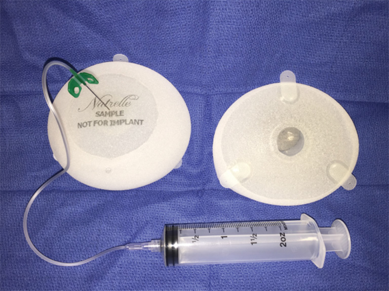 Evolution and update on current devices for prosthetic breast