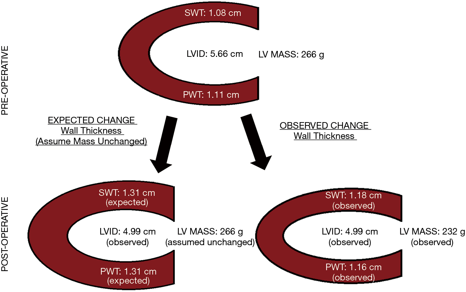 Can The Echocardiographic Lv Mass Equation Reliably Demonstrate Stable Lv Mass Following Acute Change In Lv Load Patel Annals Of Translational Medicine