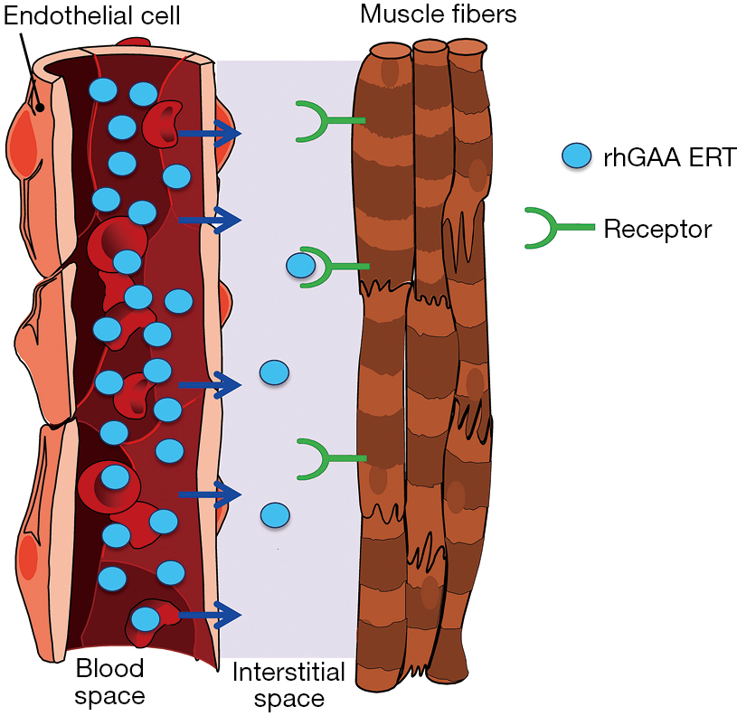 Challenges In Treating Pompe Disease An Industry Perspective Do Annals Of Translational Medicine