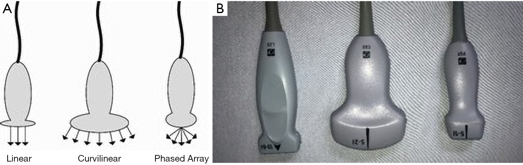 Point of care ultrasound in thoracic malignancy Miles Annals of