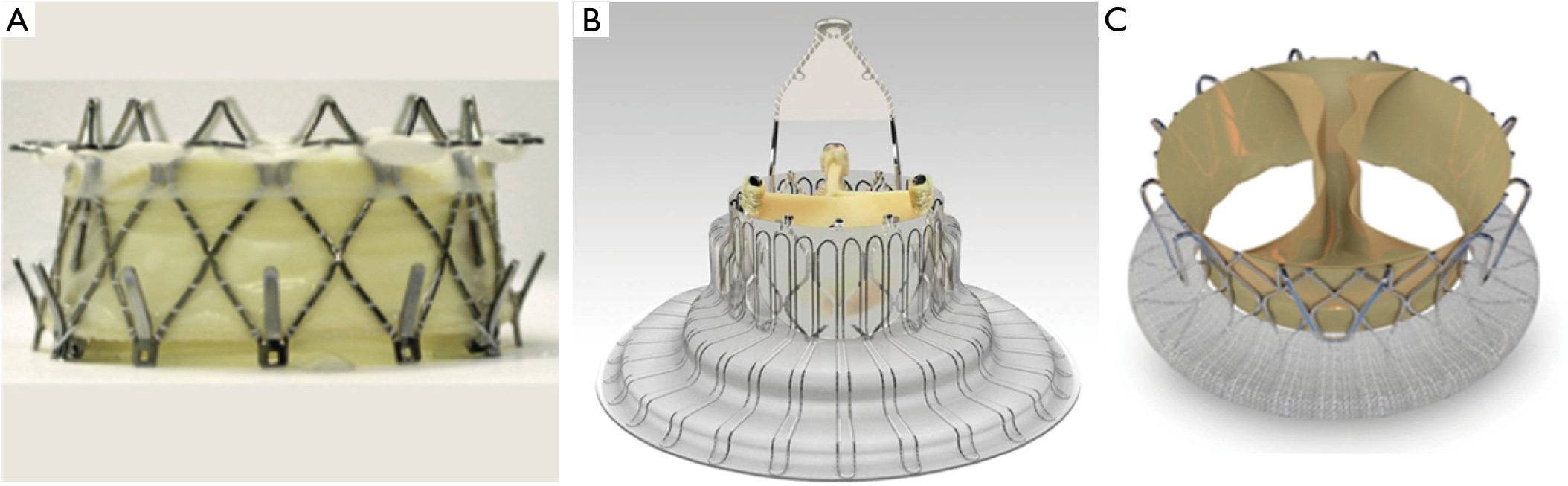 Catheter Based Treatment Of Tricuspid Regurgitation State Of The Art Santalo Corcoy Annals Of Translational Medicine Catheter Based Treatment Of Tricuspid Regurgitation State Of The Art Santalo Corcoy Annals Of Translational Medicine
