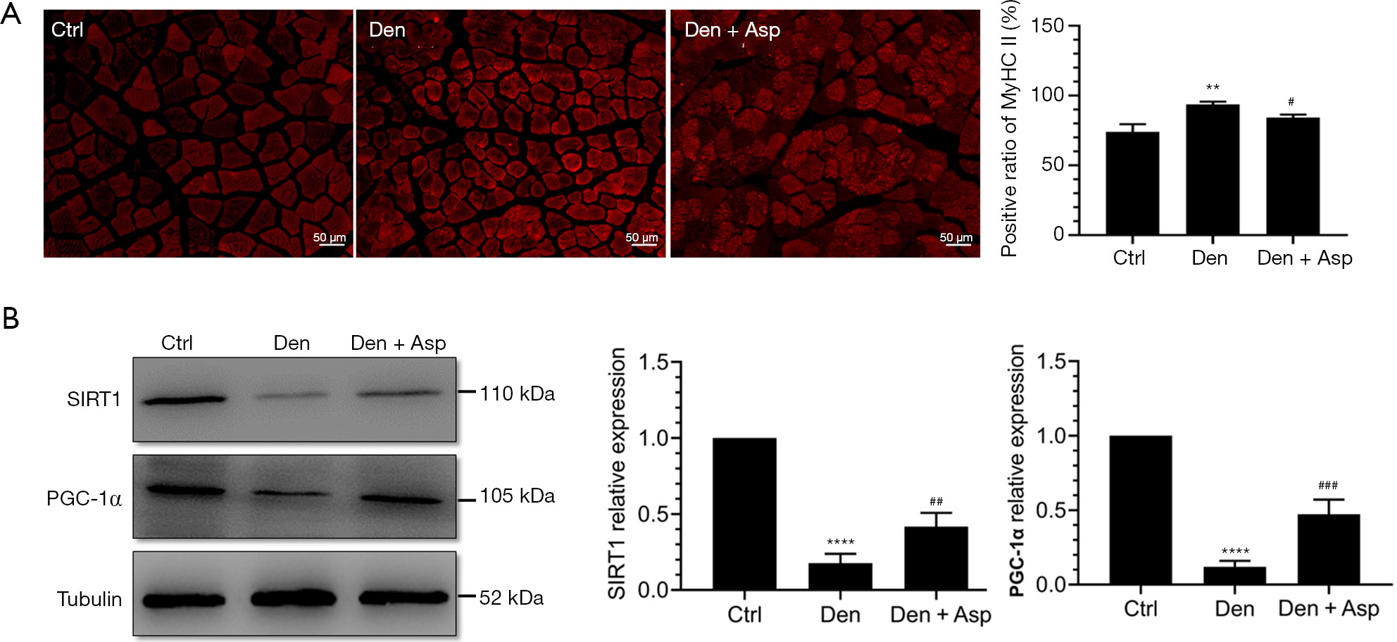 Aspirin alleviates denervationinduced muscle atrophy via regulating
