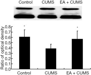 Effects of Baihui electroacupuncture in a rat model of