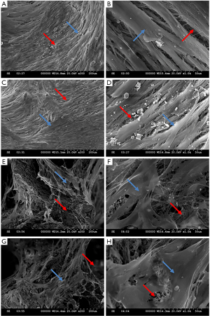 Healing of bone defects by induced pluripotent stem cell