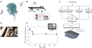 First human implantation of the WFMA for intracortical visual