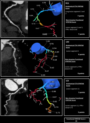 Consciente inestable Una efectiva Integration of non-invasive functional assessments with anatomical risk  stratification in complex coronary artery disease: the non-invasive  functional SYNTAX score - Collet - Cardiovascular Diagnosis and Therapy