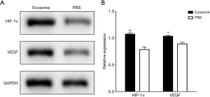 Exosomes derived from human amniotic fluid mesenchymal stem cells ...