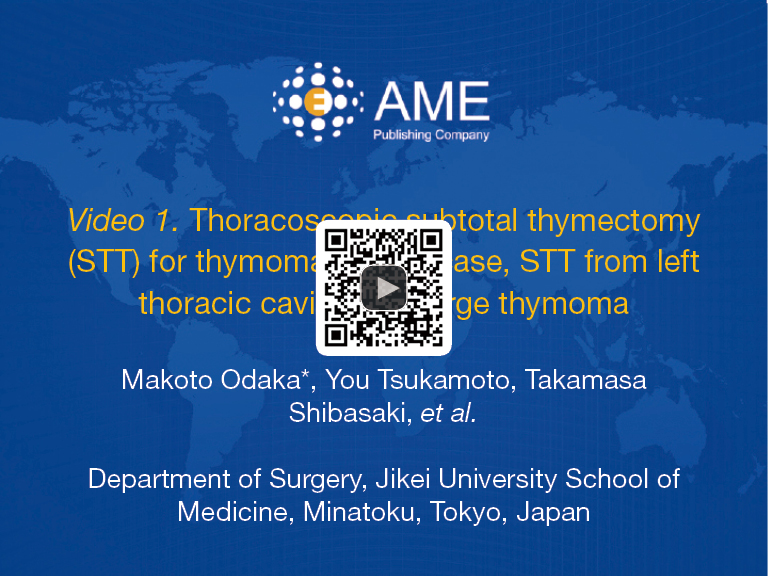 Surgical and oncological of thoracoscopic thymectomy for