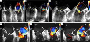 各種CD Amazon.co.jp: △ZX 中条きよし うそ 理由(わけ) 8cmシングル CD