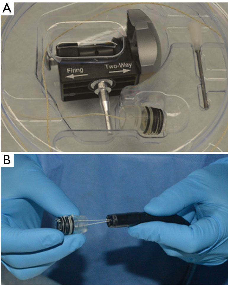 Endoscopic mucosal ablation and resection of Barrett’s esophagus and