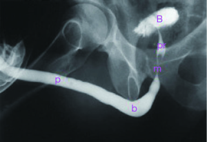 Imaging of urethral stricture disease - Maciejewski - Translational