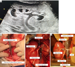 ボード Reproducible porcine model for kidney allotransplantation of